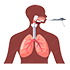 Best Bronchoscopy Treatment